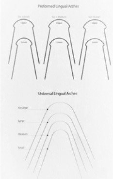 Lingual-NiTi-Arch-Wires.jpg Lingual NiTi Arch Wires