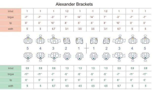 Alexander Brackets