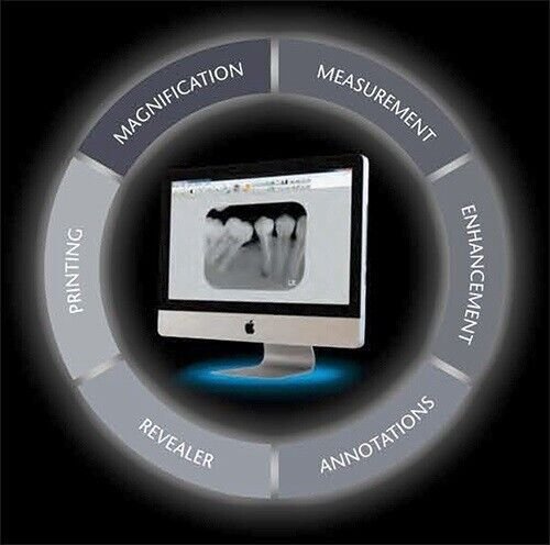 Apixia-Scanner-Tools-you-need-when-you-need-them.jpg Apixia Digirex PSP Scanner