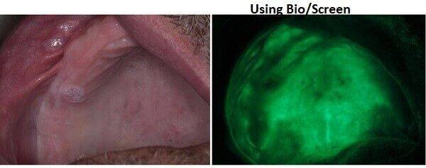 Bio Screen Oral Examination Light - AdDent