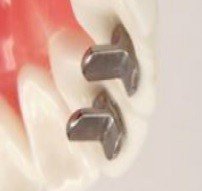 Opti-MIM Bite Guide - Ortho Organizers