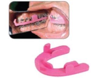 Bruxism Splints - Dentsply Sirona
