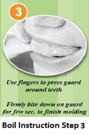 Dental-Mouth-Guard-Step-3.jpg Dental Mouth Guard