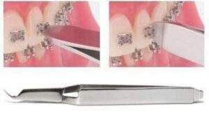 Direct Bond Tweezers with Bracket Aligner