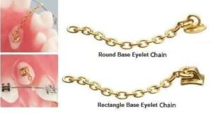 Eyelet Chain Eruption Appliance