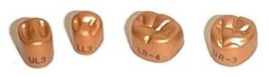 TemGold Gold Aluminum Crowns - 1st Molar