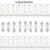 Lingual-Brackets.jpg Lingual Brackets