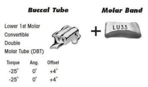 1st Molar Bands Assembly with Lower DBT Buccal Tube