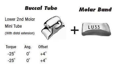2nd Molar Band Assembly with Lower Single Buccal Tube
