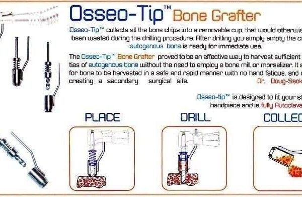 Tip Bone Grafter - Osseo