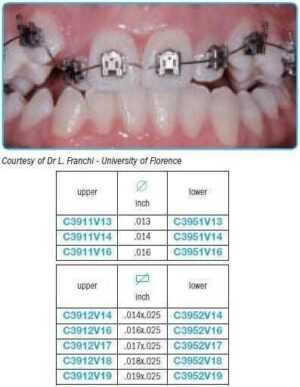 Performed archwires V bend for self-ligating brackets - Leone