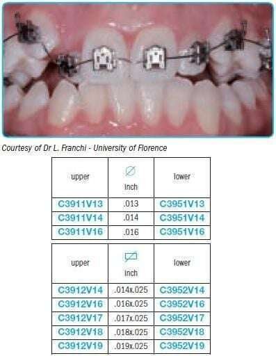Performed archwires V bend for self-ligating brackets - Leone