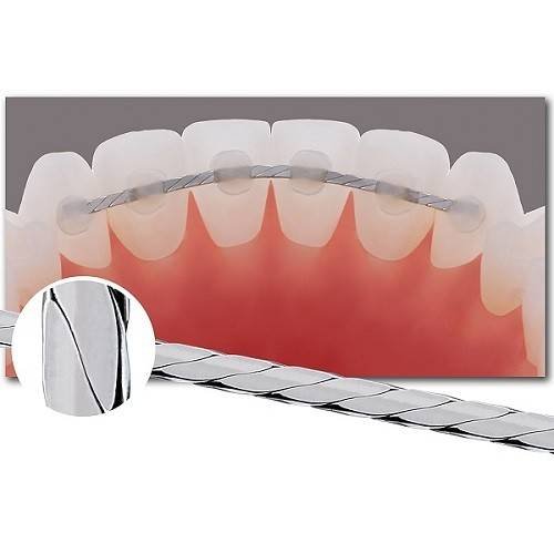 Retainer-Wire-Braided-01.jpg Retainer Wire Braided -