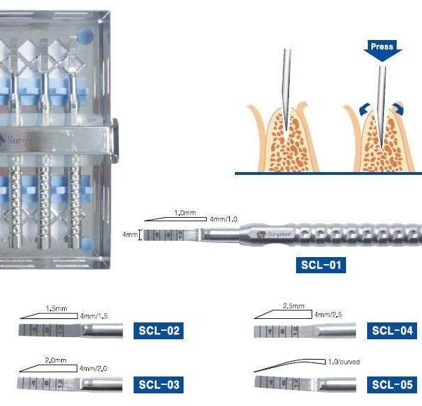Ridge-Split-Set.jpg Ridge Split Set