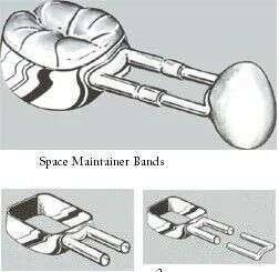 Space-Maintainer-Bands-DSC.jpg Space Maintainer Bands - DSC