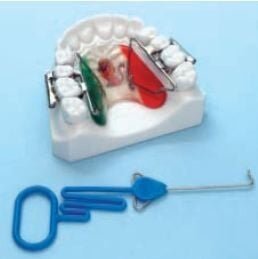 rapid-molar.jpg Rapid Molar Distalizer First Class - Leone