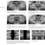 Bel Cypher - Belmont