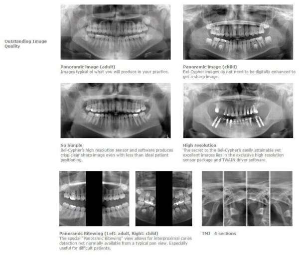 Bel Cypher - Belmont