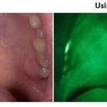 Bio Screen Oral Examination Light - AdDent