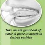 Dental Mouth Guard