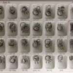 Space Maintainer Bands - DSC