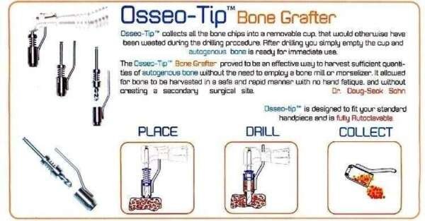 Tip Bone Grafter - Osseo