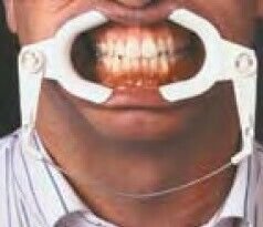 Adjustable Cheek Retractor Wire Type - Ortho Organizers