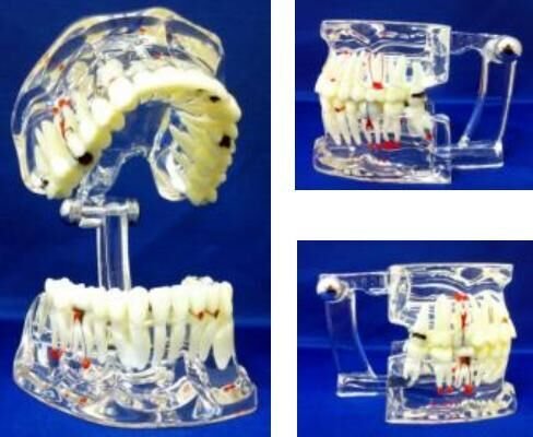 Adult Study Model -Transparent