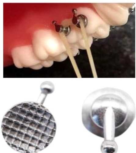 Bondable Lingual Button with hook