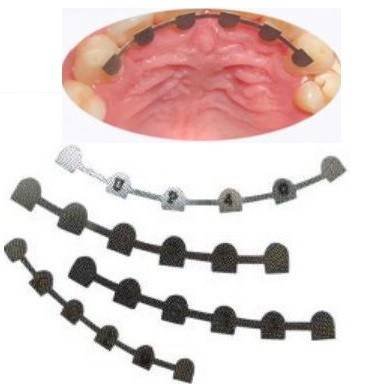 Bondable Lingual Retainer