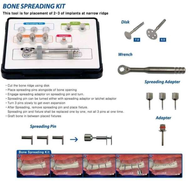 Bone Spreading Kit - Surgident