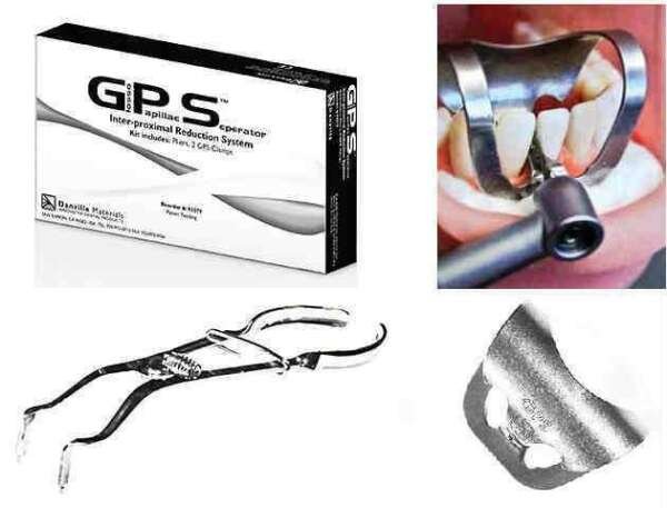 C-Saw Inter-Proximal Finishing System - Danville