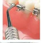 Double Ended Distal Bender