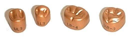 Gold Anodized Crowns - 1st Molar