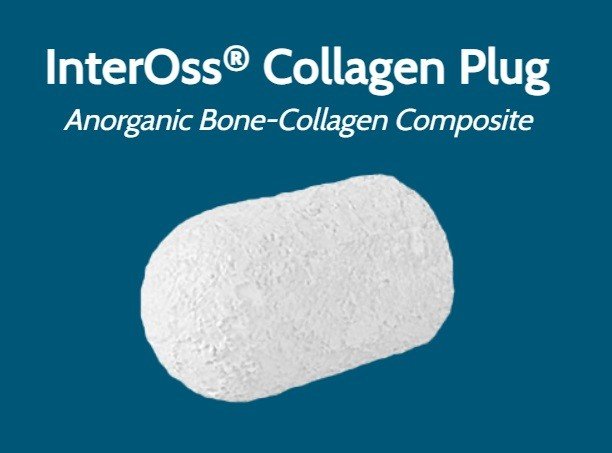 InterOss Collagen Plug 1 InterOss Collagen Plug
