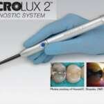 Microlux 2 Transilluminator - AdDent