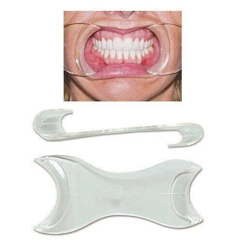 EXTAND Photography Cheek Retractor