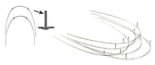 Posted Stainless Steel Archwire