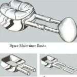 Space Maintainer Bands - DSC