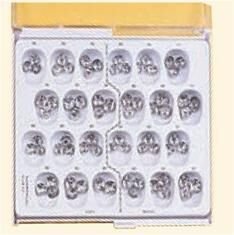 Stainless Steel Replacement Crowns - DA