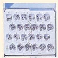 Stainless Steel Second Primary Molar Crowns Replacement - DA