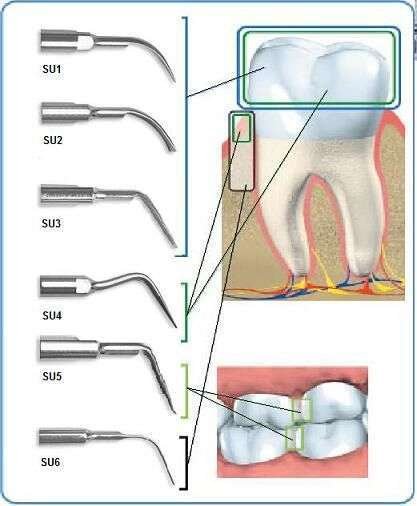 Ultrasonic Piezo Tips (Vista)