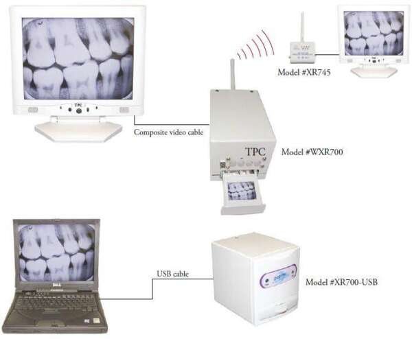 X-ray Film Reader- TPC
